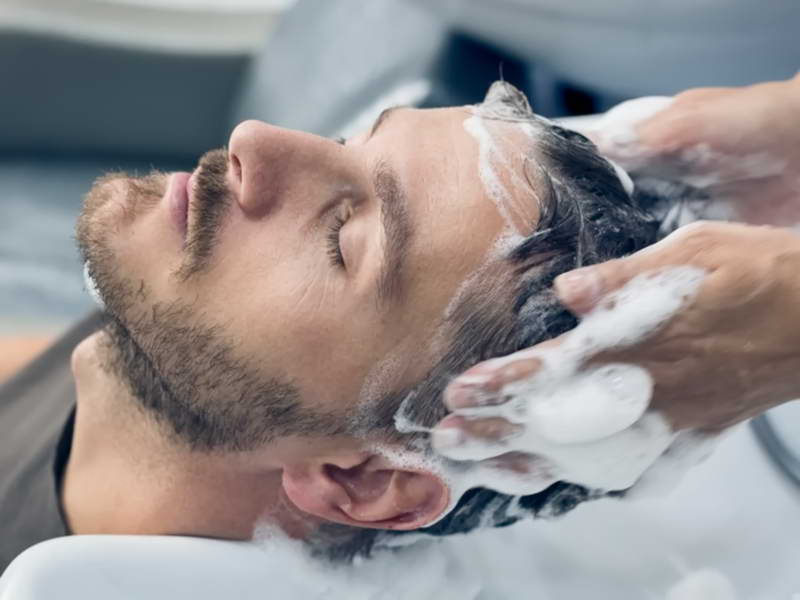 What To Do After Hair Transplantation ?