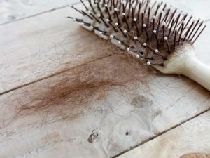 Hair Transplant Turkey 2018