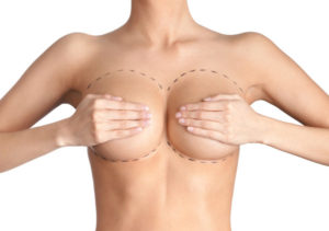 Breast Aesthetic