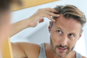 Need to Know Before Getting Hair Transplants