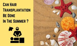 Hair Transplantation In The Summer