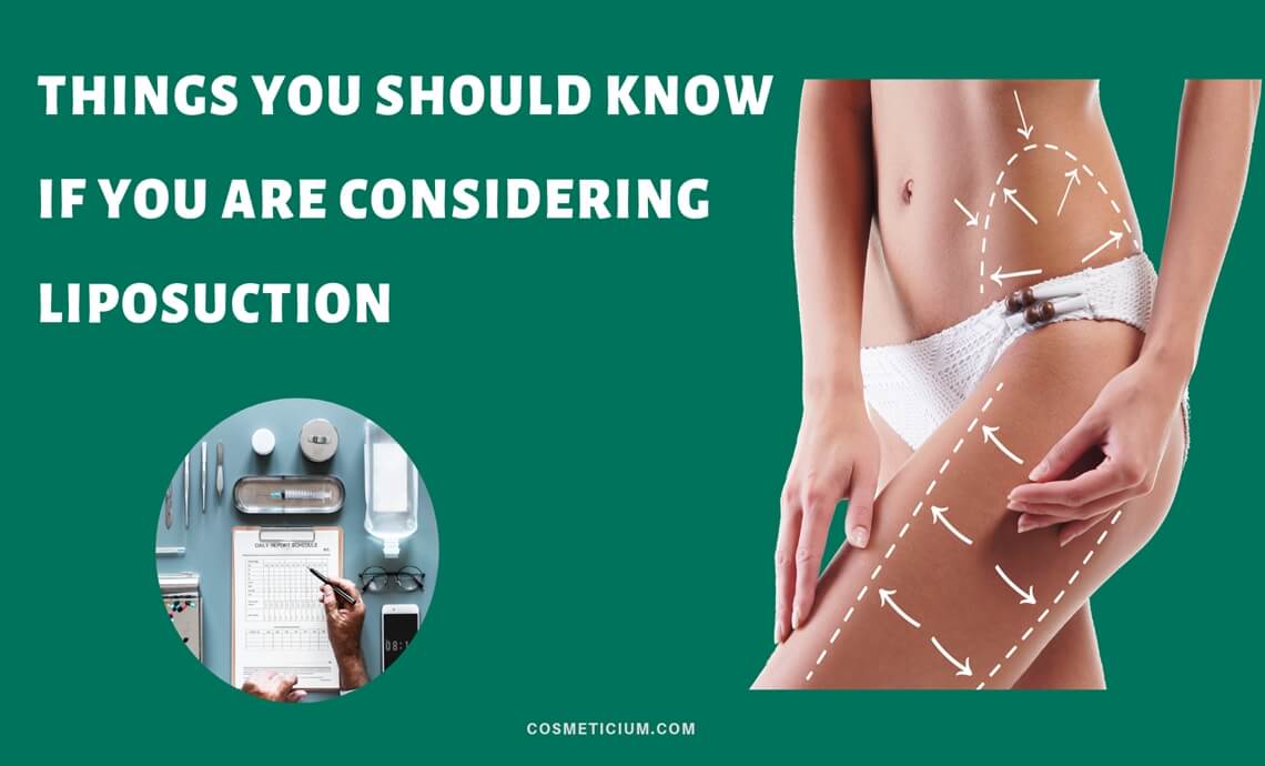 Things You Should Know If You Are Considering Liposuction