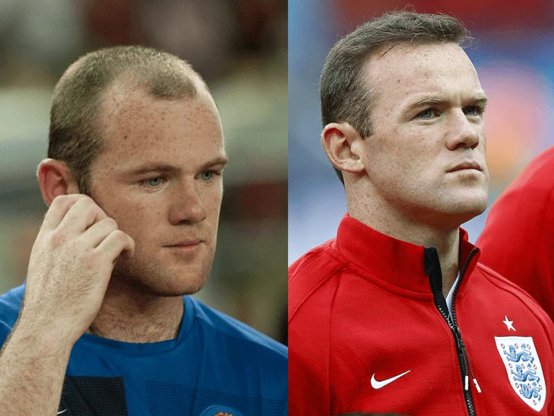 Wayne Rooney back at the hair surgery center and pleased as punch   ProSoccerTalk  NBC Sports