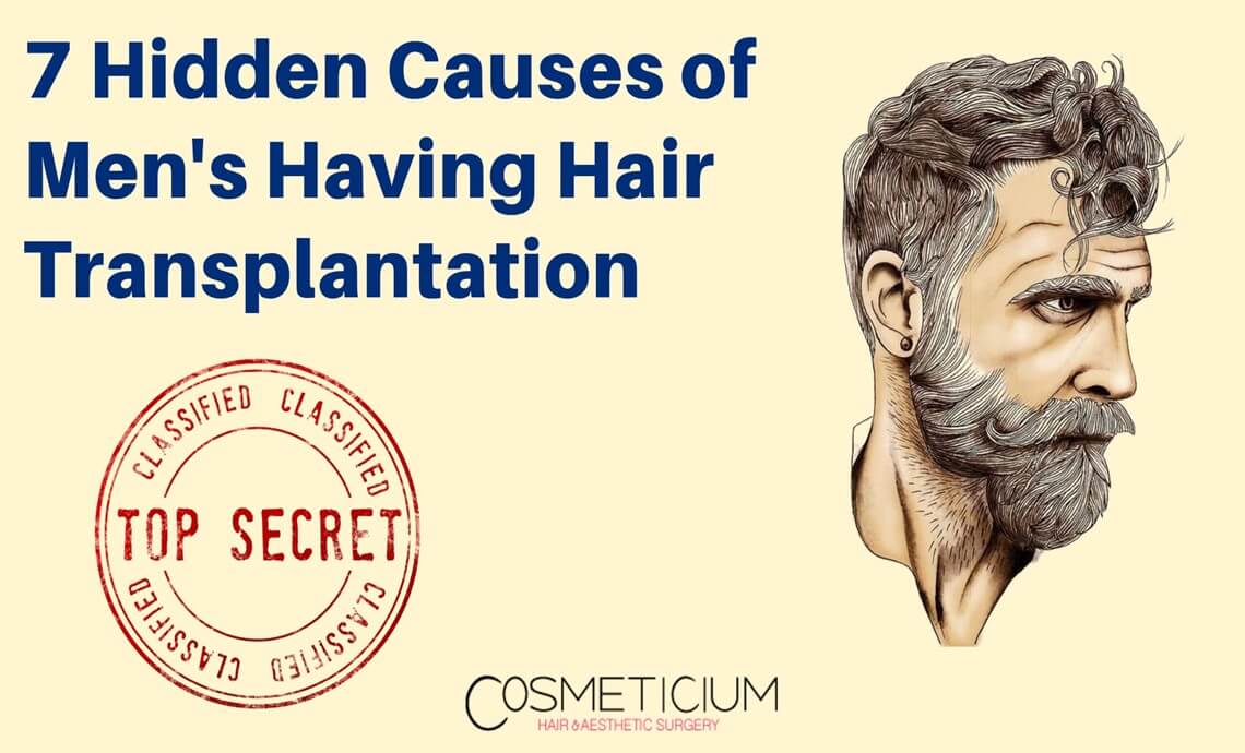 7 Versteckte Ursachen für Haartransplantationen bei Männern