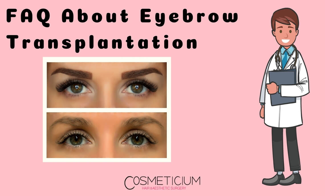 Frequently Asked Questions About Eyebrow Transplantation