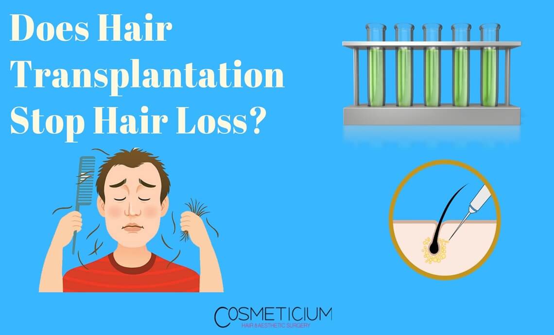Does Hair Transplantation Stop Hair Loss?