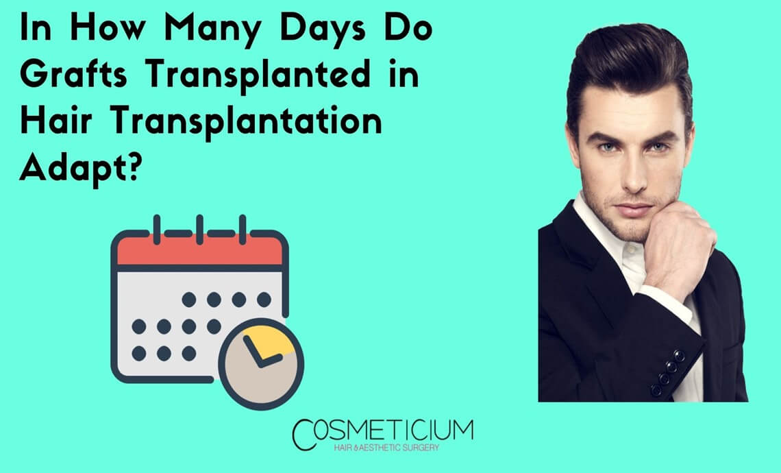 In How Many Days Do Grafts Transplanted in Hair Transplantation Adapt?