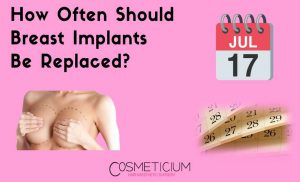 Breast Implants