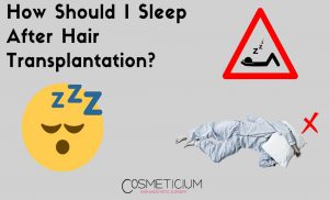 Sleeping Positions After Hair Transplant