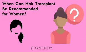 Hair Transplant for Women