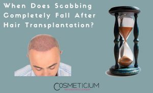Scabbing Fall After Hair Transplantation