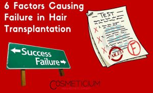 Causing Failure in Hair Transplantation