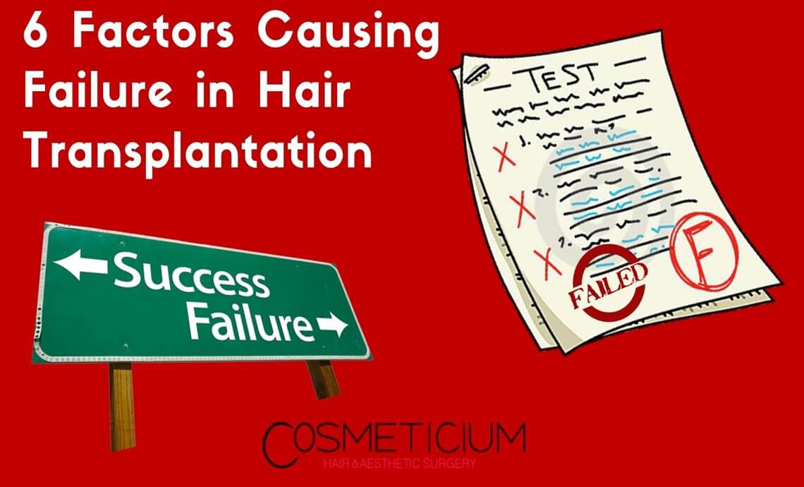 6 Factors Causing Failure in Hair Transplantation