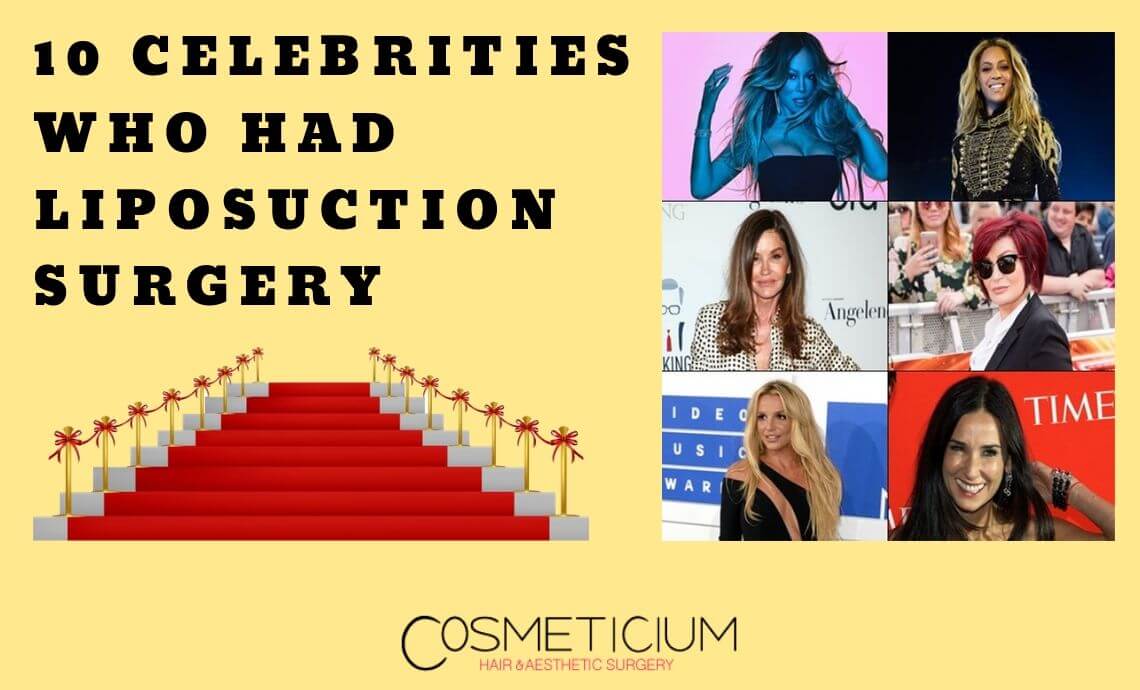 10 Celebrities Who Had Liposuction Surgery