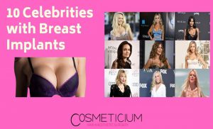 Celebrities Had Breast Implants