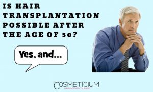 Hair Transplantation in The 50s