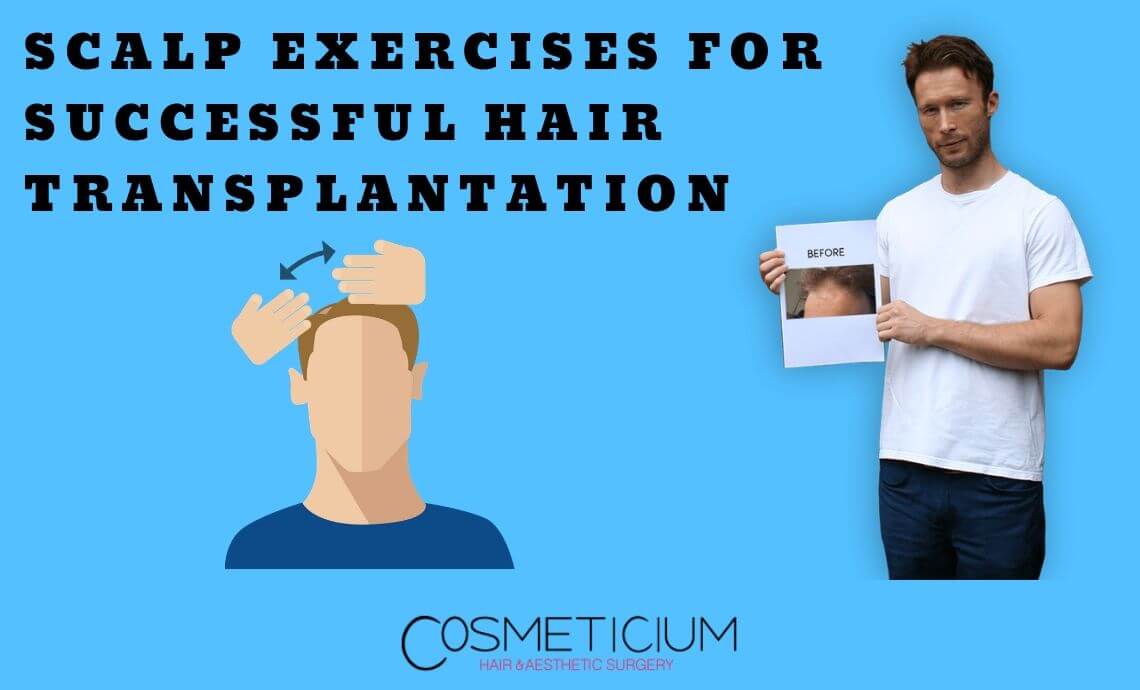 Scalp Exercises for Successful Hair Transplantation