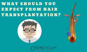 Expecting from Hair Transplantation