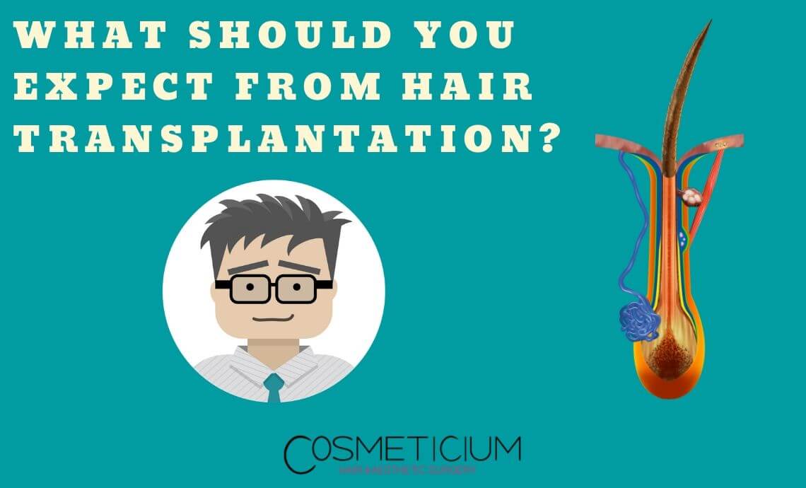 What Should You Expect from Hair Transplantation?