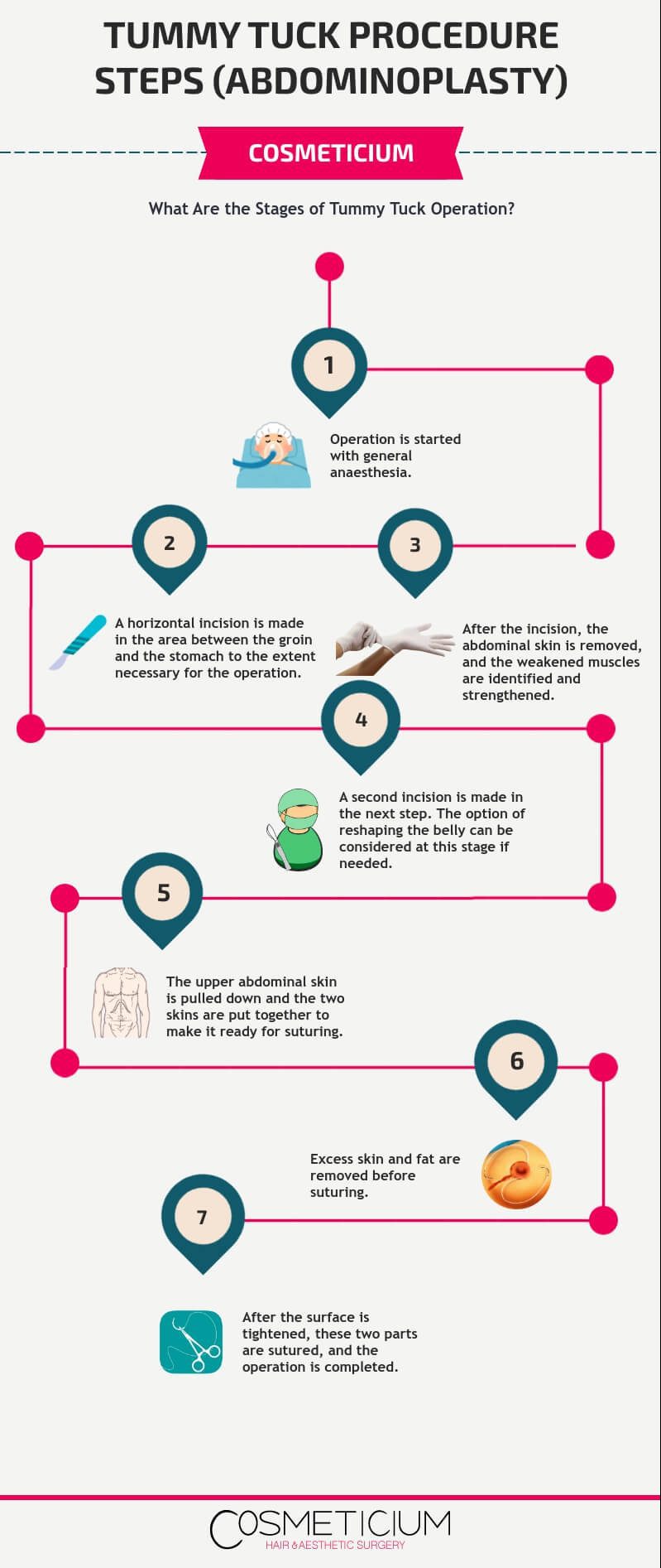 Abdominoplasty Procedure Steps Infographic