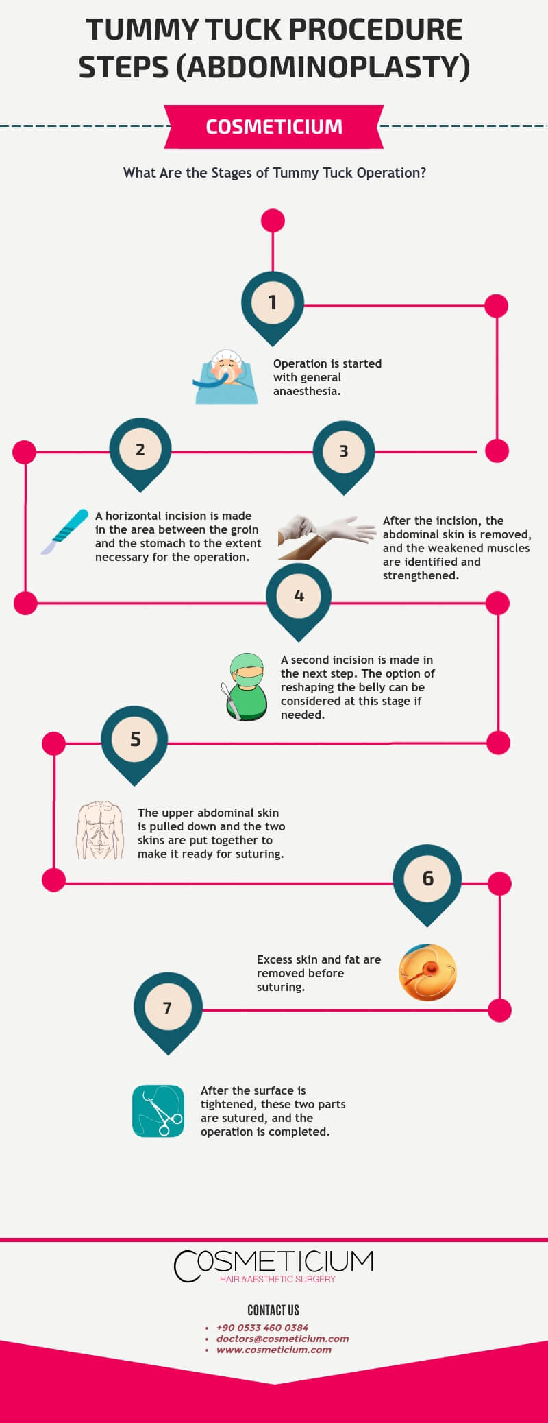 Abdominaplasty Procedure Steps Infographic