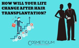 Life After Hair Transplantation