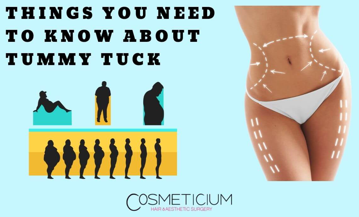 Things You Need to Know About Tummy Tuck