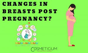 Aesthetic after pregnant