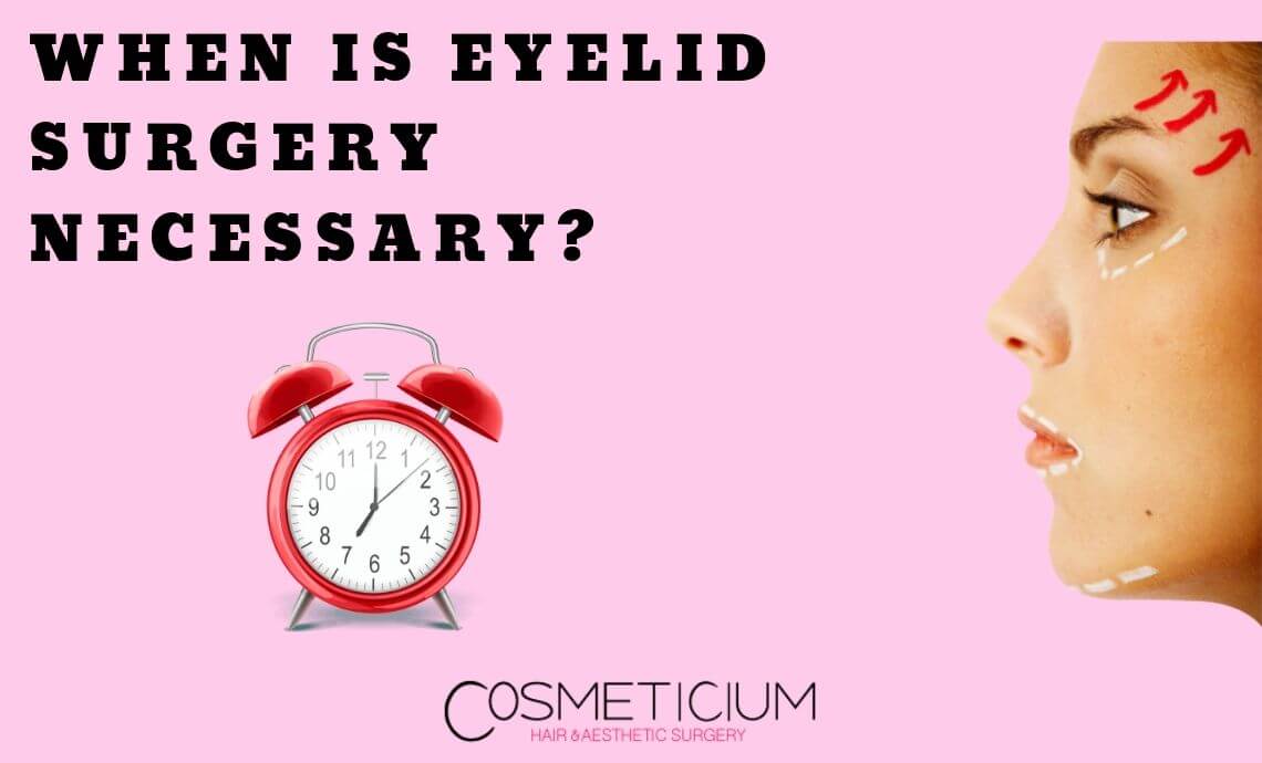 When is Eyelid Surgery Necessary?