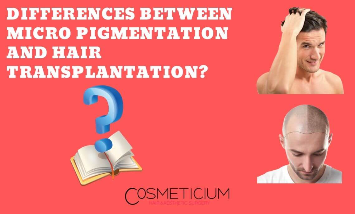 Differences Between Micro Pigmentation and Hair Transplantation