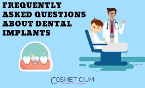The Dental Implants Procedure
