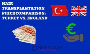 Hair Transplant in Turkey or England