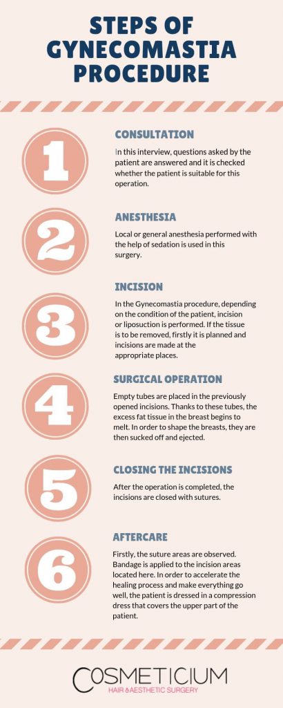 Gynecomastia Surgery Steps