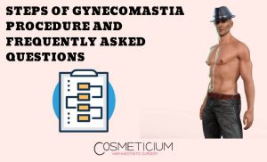 Frequently Asked Questions About Gynecomastia