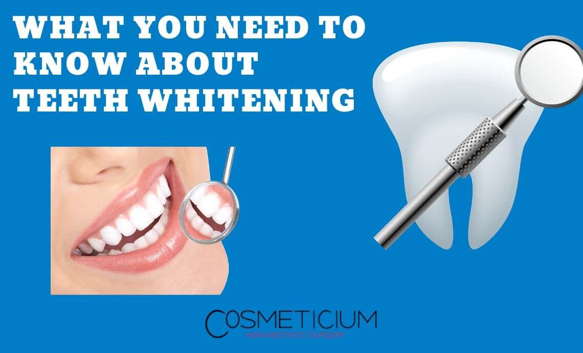 What You Need to Know About Teeth Whitening