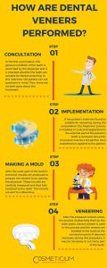 How Are Porcelain Dental Veneers Performed? (Infographic)