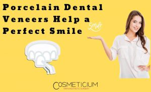 Porcelain Dental Veneers