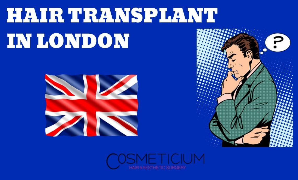 Should I Have Hair Transplantation in London?