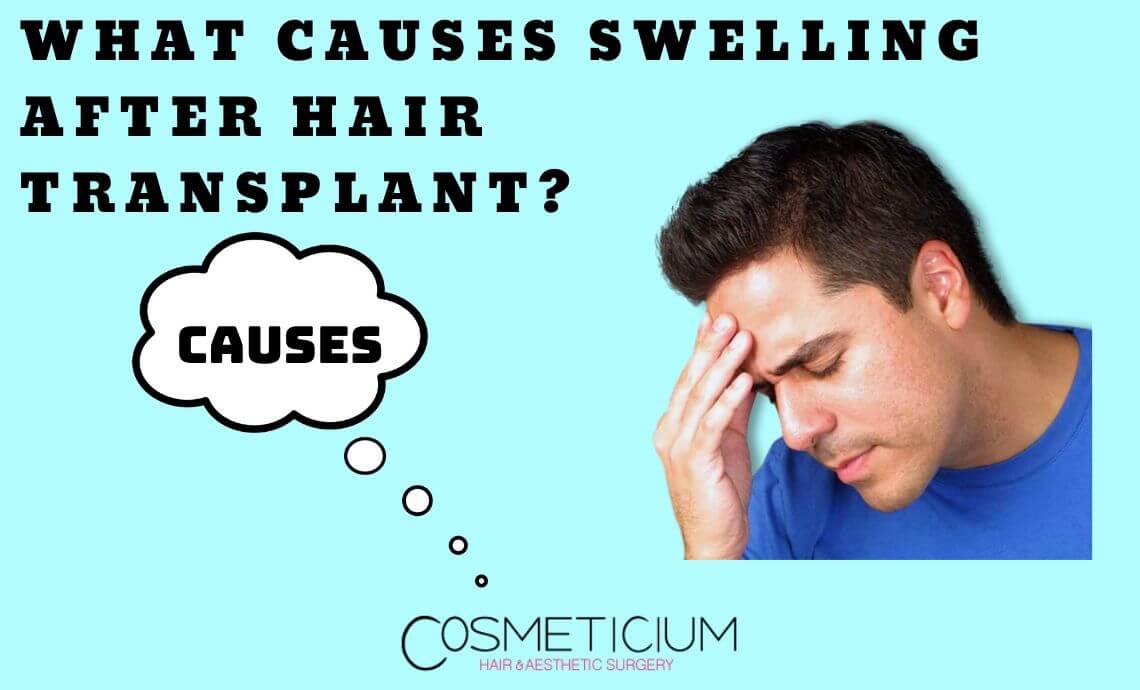 What Causes Swelling After Hair Transplantation?