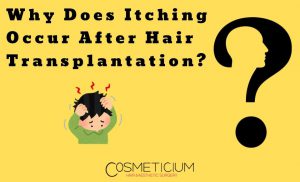 Causes of Itching After Hair Transplantation