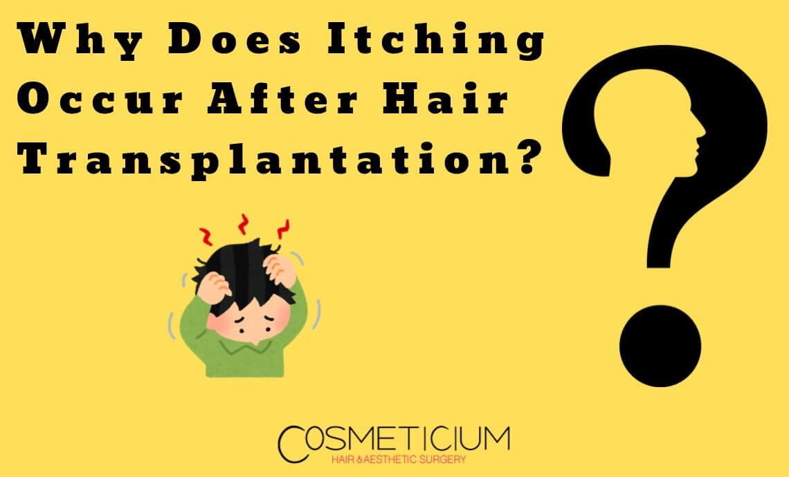 Why Does Itching Occur After Hair Transplantation?