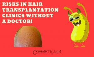 Hair Transplant Operation Without a Doctor