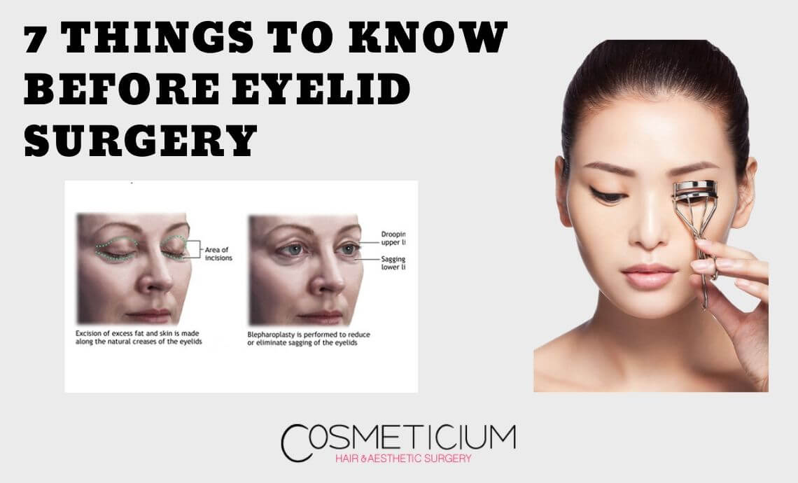 7 Things to Know Before Eyelid Surgery