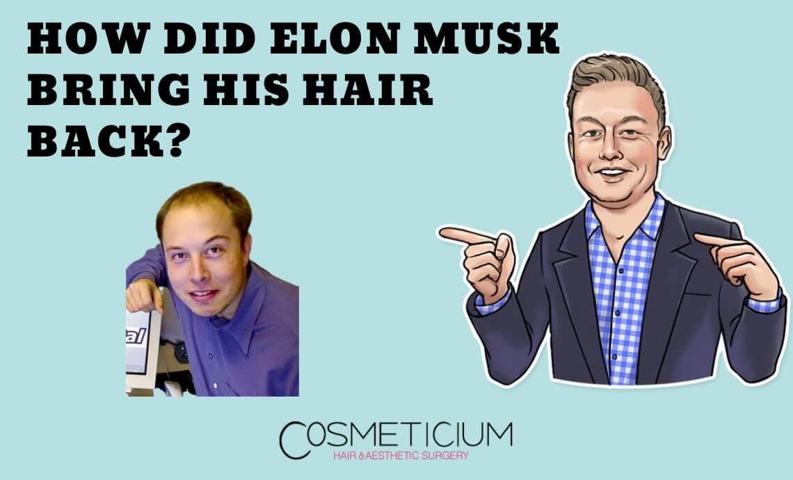 Elon Musk Hair Transplant: How Did He Get His Hair Back?