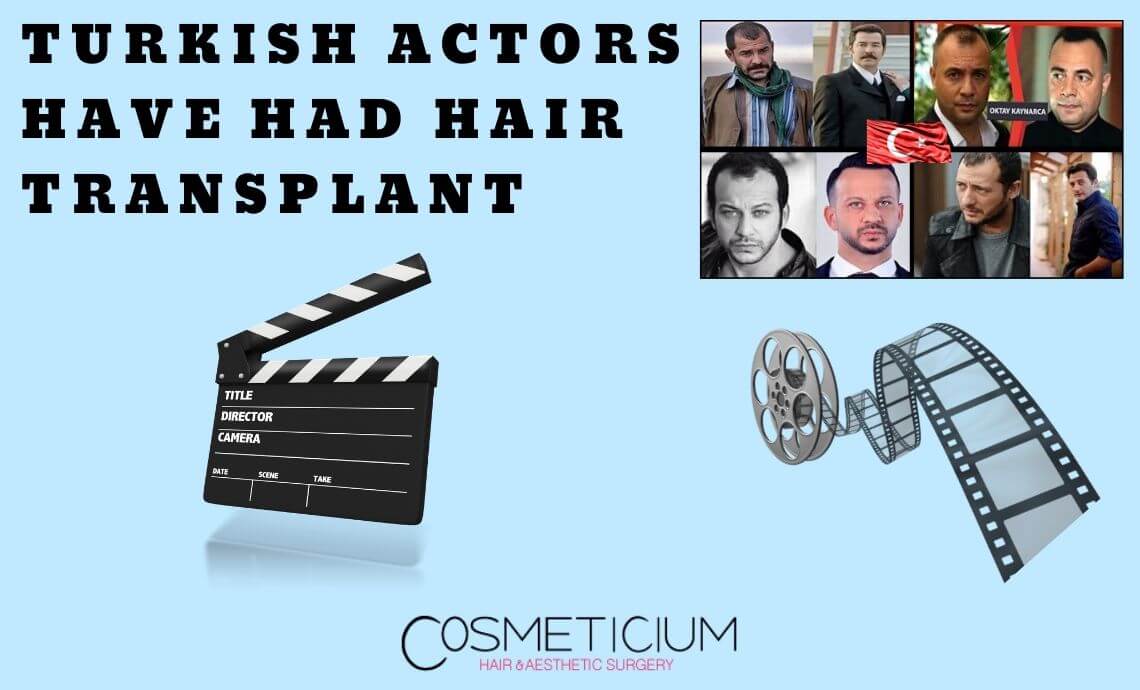 You’ll Never Believe These Turkish Actors Have Had Hair Transplantation