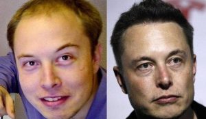elon-musk-before after
