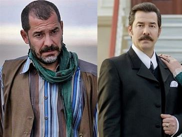 Turkish Actors Hair Transplantation: Fikret Kuşkan