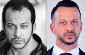 Turkish Actors Hair Transplantation: Rıza Kocaoğlu