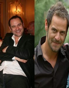 Turkish Actors Hair Transplantation: Tardu Flordun