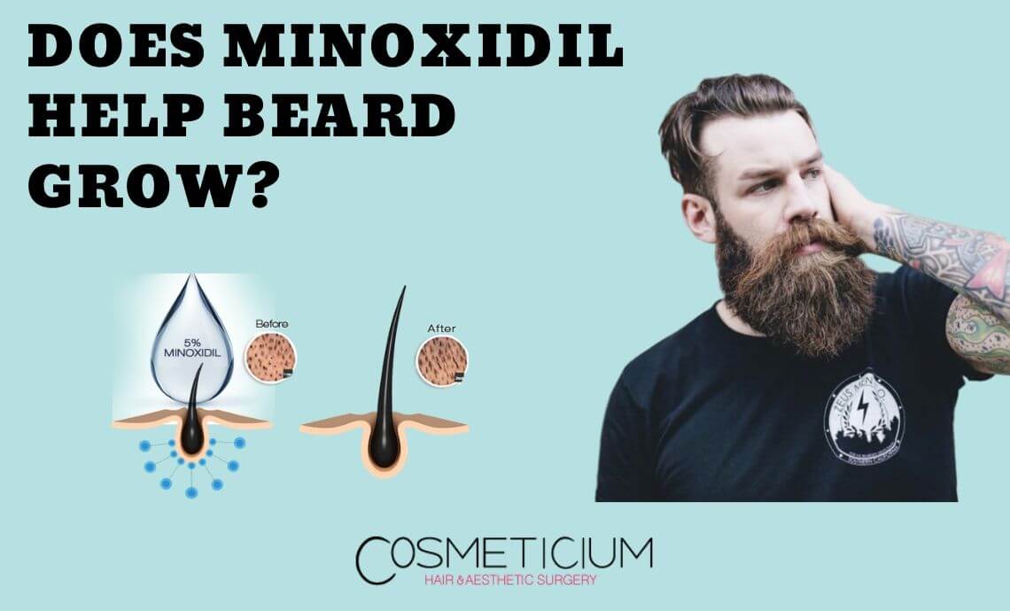 Does Minoxidil Help Beard Grow?